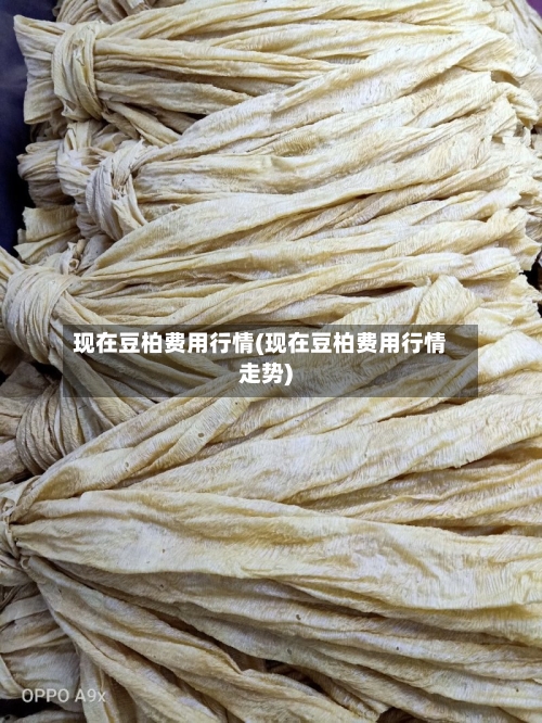 现在豆柏费用行情(现在豆柏费用行情走势)-第2张图片