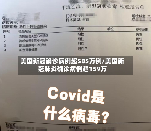 美国新冠确诊病例超585万例/美国新冠肺炎确诊病例超159万
