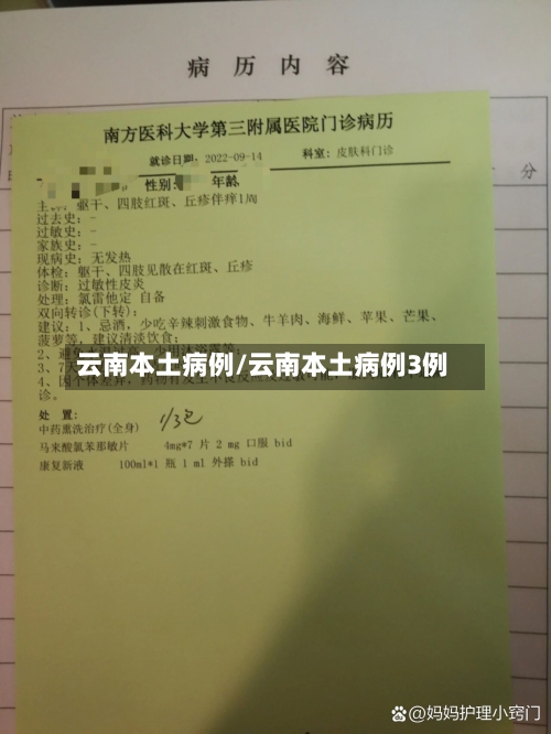 云南本土病例/云南本土病例3例